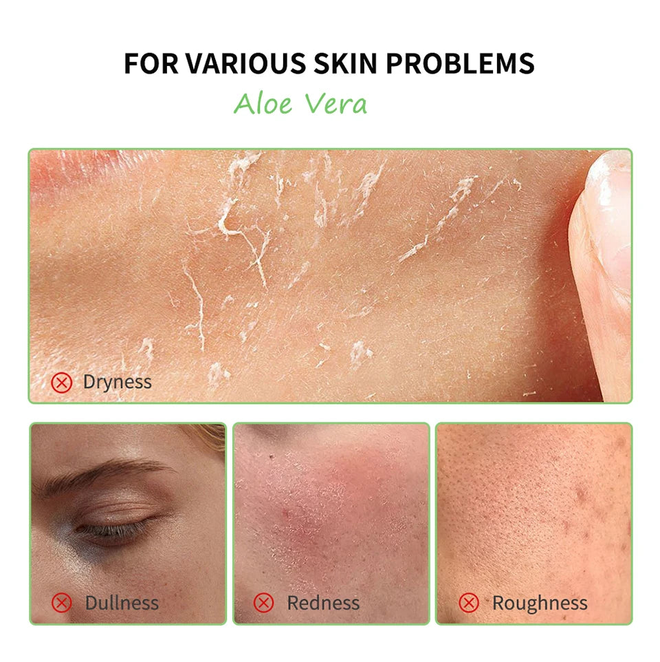 Aloe Vera Skin Care Set – 6-in-1 Deep Moisturising, Brightening & Nourishing Kit
