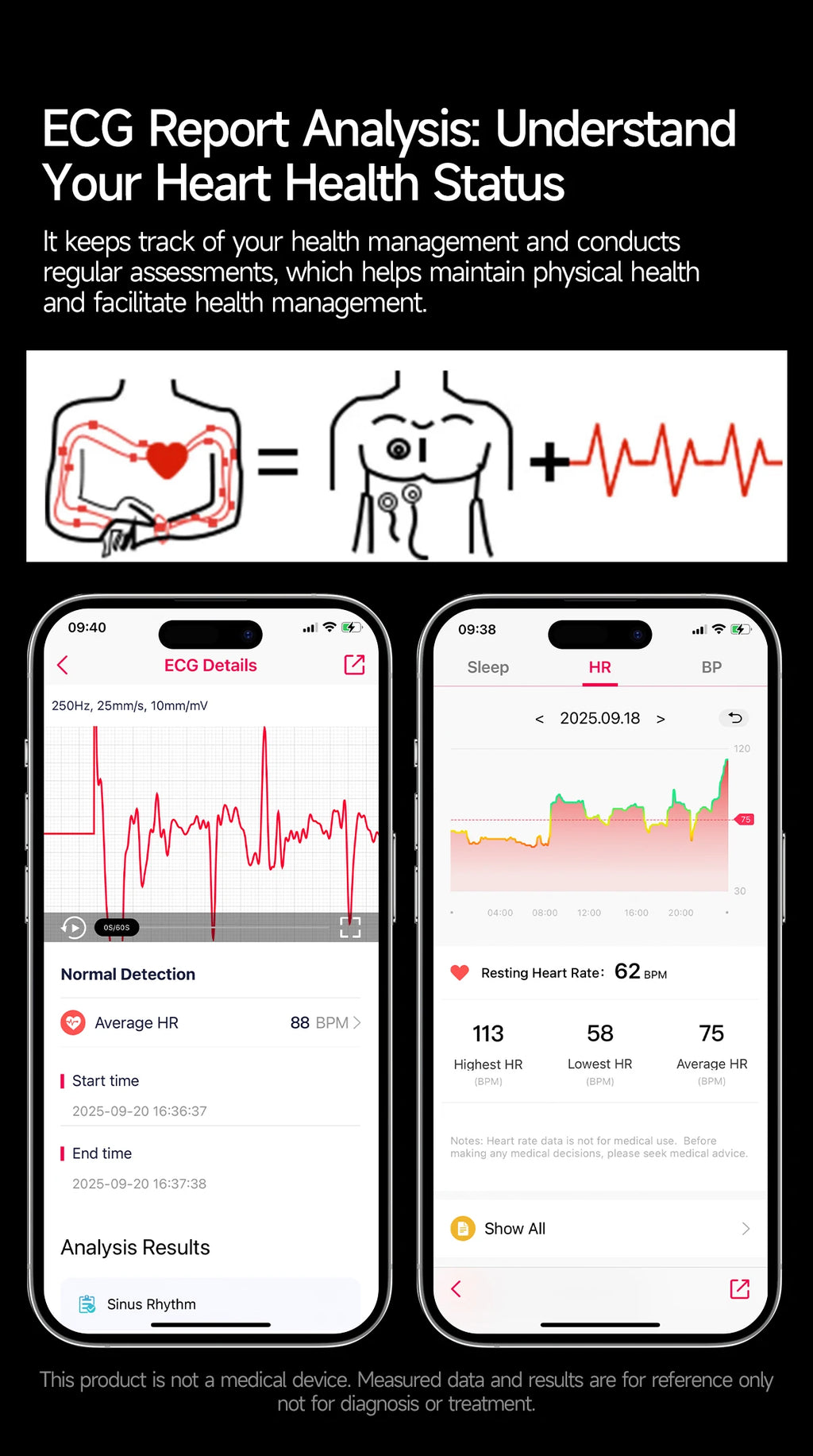 2026 New Diagnosis ECG Smart Watch Sport AI Accurate Uric Acid Blood Pressure Body Fat Five Organ Fitness Waterproof Smartwatch