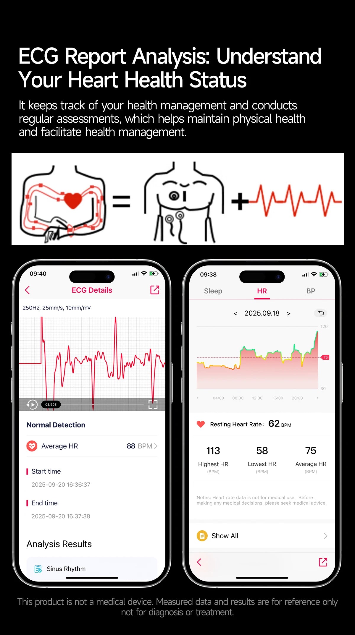 2026 New Diagnosis ECG Smart Watch Sport AI Accurate Uric Acid Blood Pressure Body Fat Five Organ Fitness Waterproof Smartwatch