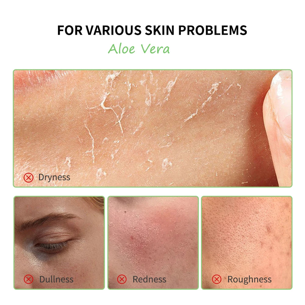 Aloe Vera Skin Care Set – 6-in-1 Deep Moisturising, Brightening & Nourishing Kit